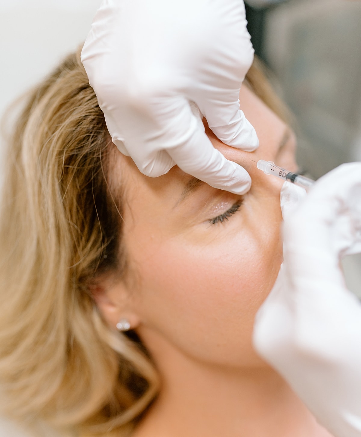 Cosmetic treatment being administered to a woman's forehead.