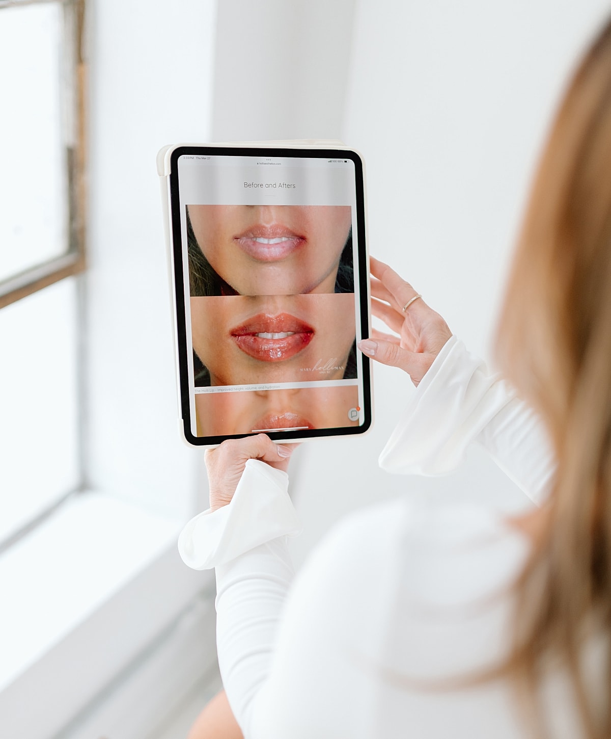 Before and after lip treatment comparison on tablet.